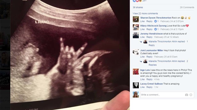 sonogram captures baby s cool hand signal